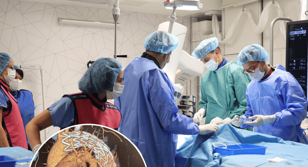 AS_ intervencija_TEVAR1